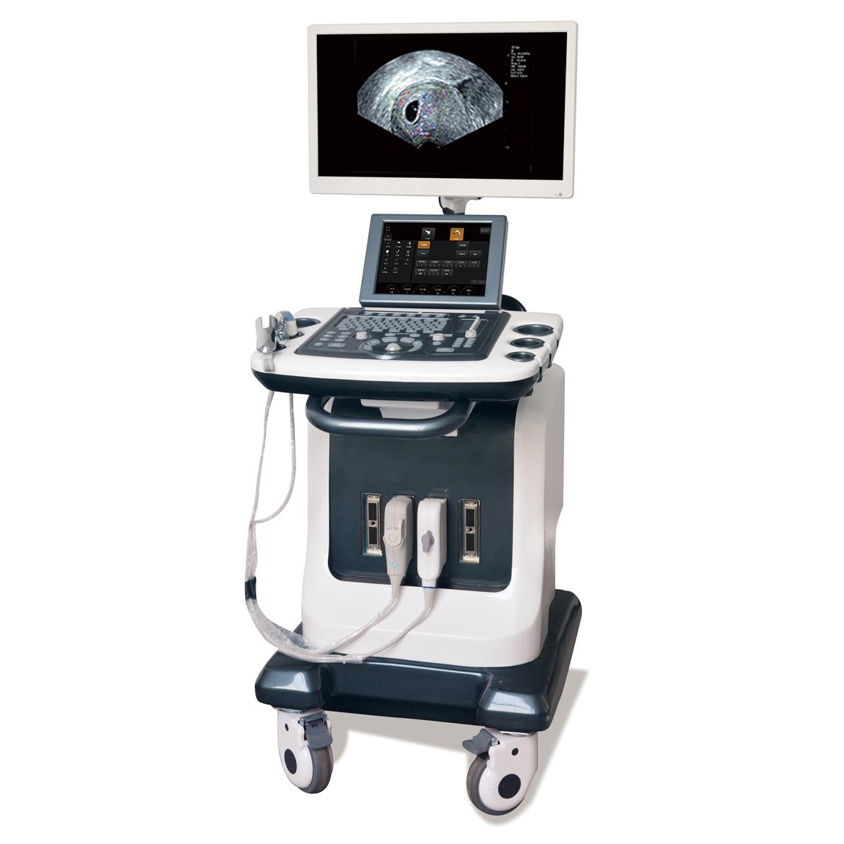 全數(shù)字超聲引導(dǎo)婦科宮腔手術(shù)儀